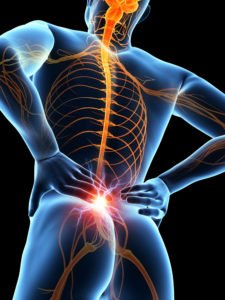 Clearwater Levaquin Nerve Damage Lawyers | The Law Place Clearwater Levaquin Nerve Damage Lawyer