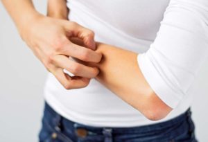 A woman scratching her arm that has a rash.