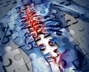 puzzle of a spine with a piece missing