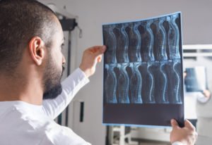 doctor observing spine x-rays